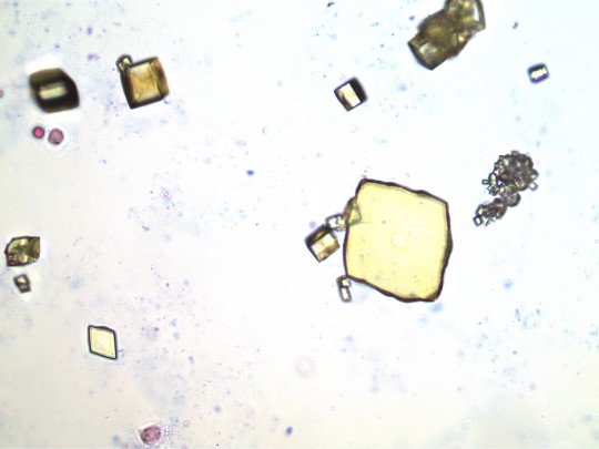 31. Kyselina močová (foto Ing. Ivana Hupáková, ÚKBH Plzeň)