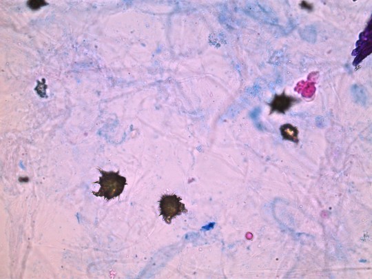 33. Močan amonný (foto Ing. Ivana Hupáková, ÚKBH Plzeň)