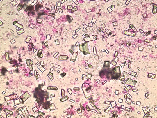 34. Tripelfosfát (foto Ing. Ivana Hupáková, ÚKBH Plzeň)