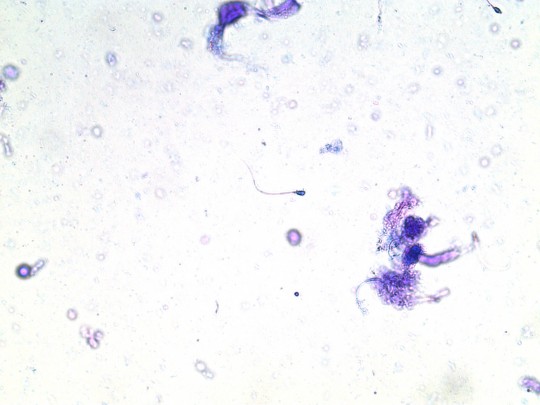 35. Spermie (foto Ing. Ivana Hupáková, ÚKBH Plzeň)