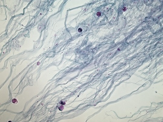 36. Hlen a leukocyty (foto Ing. Ivana Hupáková, ÚKBH Plzeň)