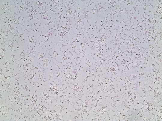 37. Bakterie (foto Ing. Ivana Hupáková, ÚKBH Plzeň)