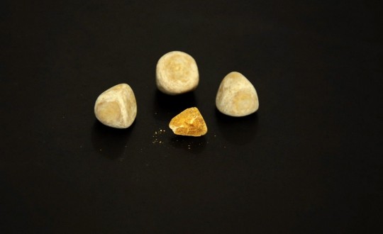 42. Kyselina močová (Ing. Ivana Hupáková, ÚKBH Plzeň)