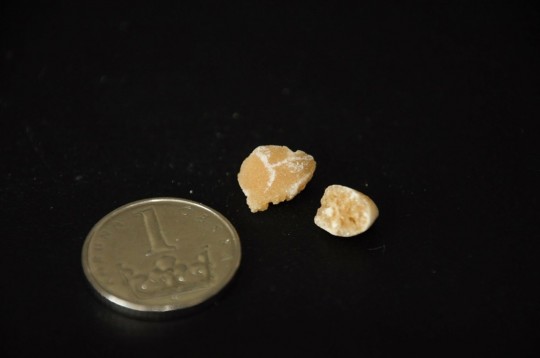 44. Cystin (Ing. Ivana Hupáková, ÚKBH Plzeň)