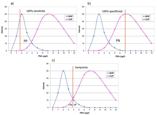 Užití PSA v odlišení benigní hyperplazie a karcinomu prostaty a vliv polohy „cut-off“ hodnoty na poměr diagnostické senzitivity a specifičnosti (podrobnosti v textu)