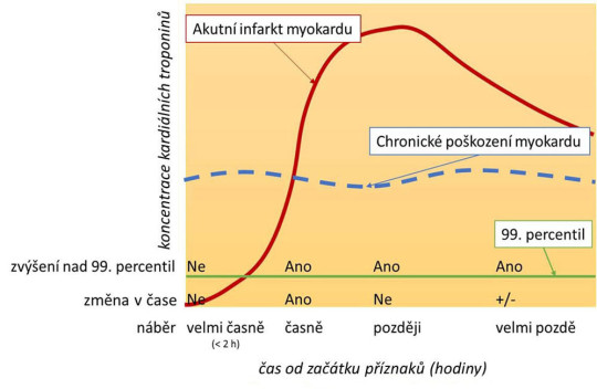Porovnání časového průběhu koncentrací kardiálních troponinů u akutního a chronického poškození myokardu
