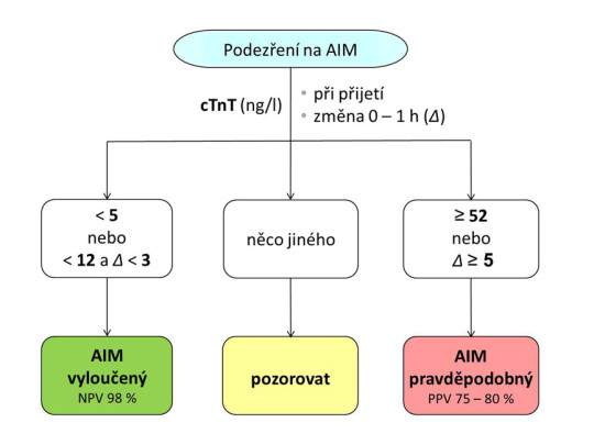 Příklad jednohodinového algoritmu při diagnostice AIM – uvedené hodnoty platí pro kardiální troponin T měřený vysoce senzitivní metodou