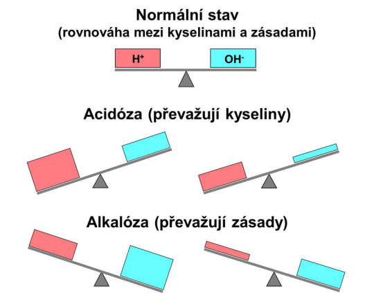 Schéma poruch rovnováhy mezi kyselinami a zásaditými látkami. Obrázek znázorňuje dvě příčiny acidózy i alkalózy – hromadění jedné ze složek (vždy vlevo) či ztráty složky druhé (vpravo)