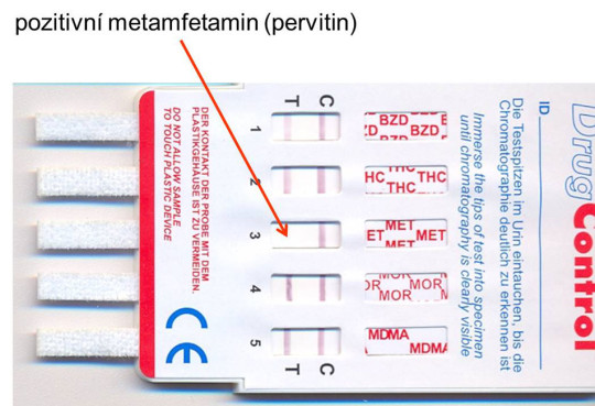 Příklad orientačního imunochemického průkazu drog v moči (pozitivita se projeví chyběním proužku v pozici T = test)
