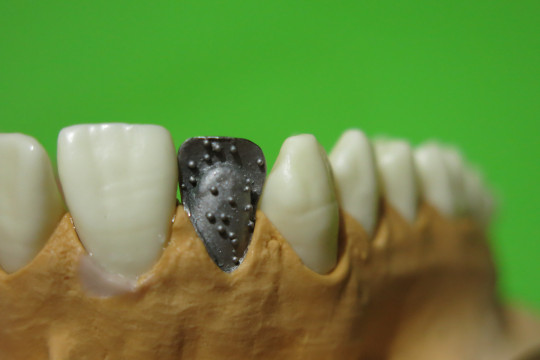 12. Opískovaná kovová konstrukce pro vytvoření kvalitní retence kov – plast