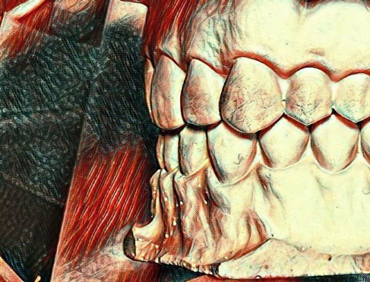 5. Angleova 1. třída – poloha špičáků