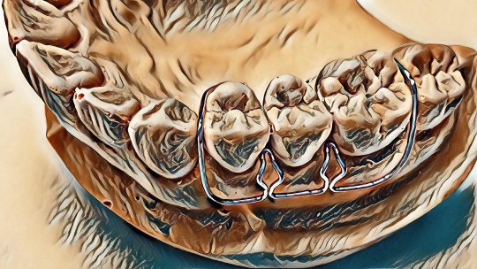 34. Dvojitá šípová spona