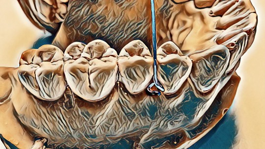 40. Trojúhelníčková spona