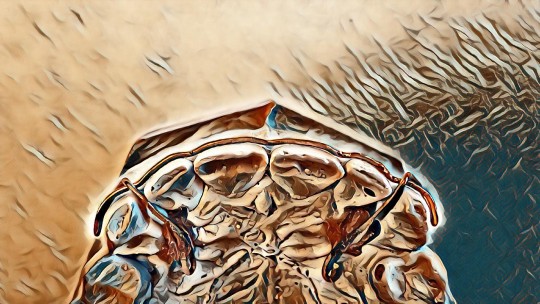 44. Labiální oblouk Van den Linden