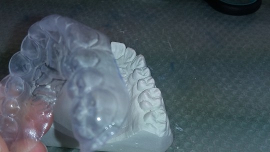 64. Retenční dlaha