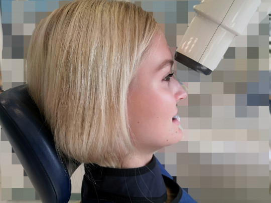 17. Okluzní projekce horní čelisti