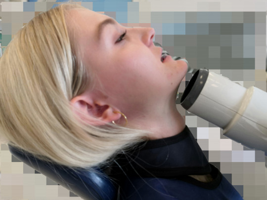 18. Okluzní projekce dolní čelisti