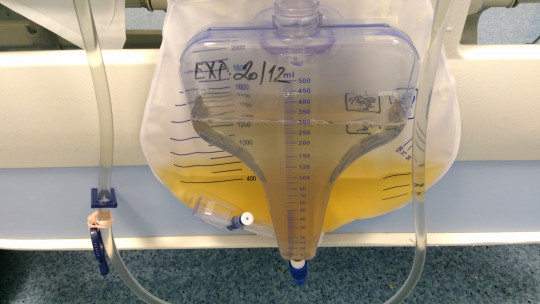 9. Sběrný sáček na moč pro přesné měření hodinové diurézy