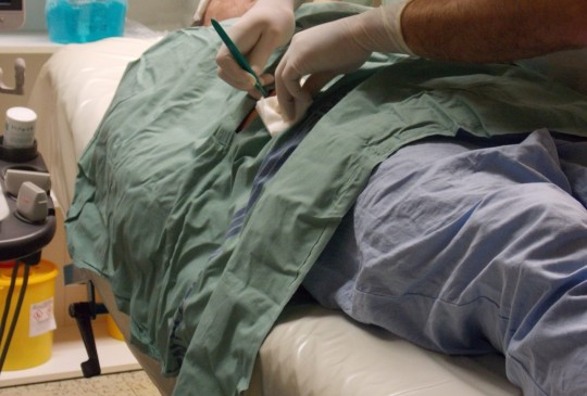 30. Proříznutí místa vpichu