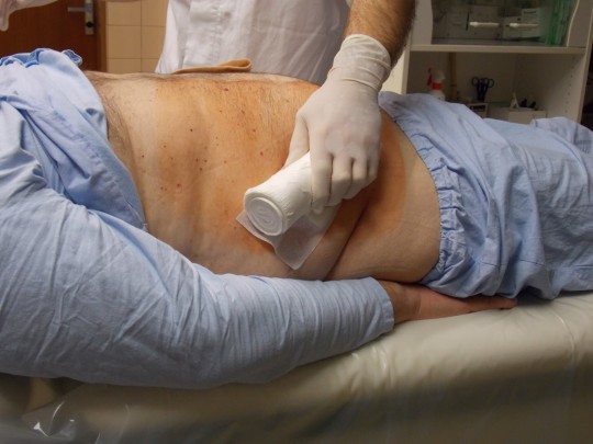 37. Komprese po provedení biopsie