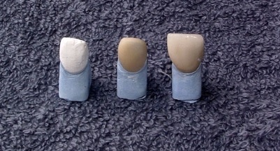 11. Infiltrovaná kapna, zleva: vymodelovaná a vysušená kapna z aluminiumoxidu, infiltrovaná kapna, hotová korunka