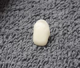 16. Základní konstrukce z keramiky