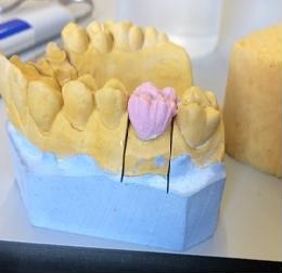 18. Základní vrstvení dentinu