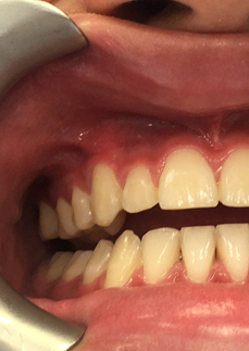 Anatomy and Physiology of Oral Cavity, Anomalies