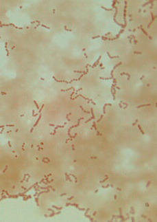 Mikrobiologie mléka a mléčných výrobků