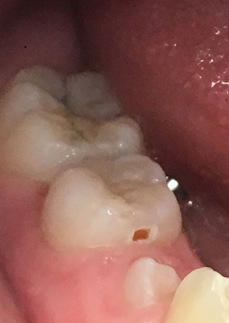 Diseases of tooth, oral cavity and suspension apparatus